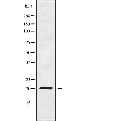 Polyclonal Rabbit anti-Human YAF2 Antibody (WB)