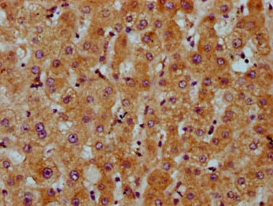 Polyclonal Rabbit anti-Human CDS2 Antibody (IHC, WB)