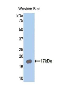AZGP1 / ZAG Antibody (aa180-298)