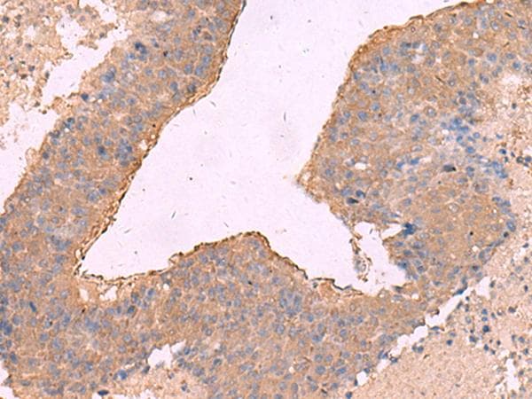 NIPSNAP1 Antibody