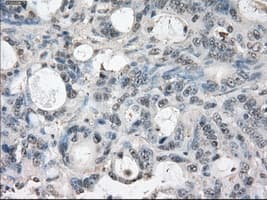 LTA4H / LTA4 Antibody (clone OTI3C11)