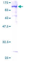 Human MLLT3 / AF9 Protein (Recombinant GST)