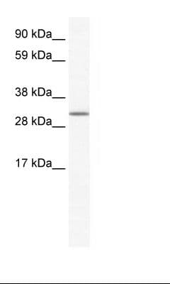 SPIC Antibody (N-Terminus, FITC)