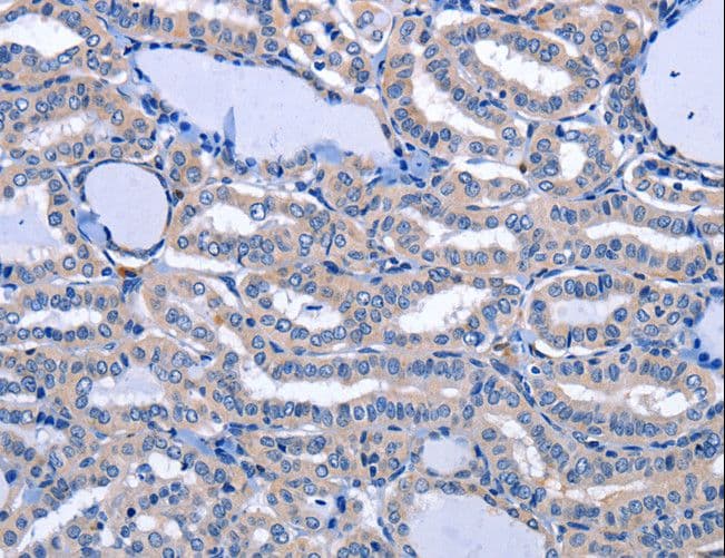 NPPB / BNP Antibody