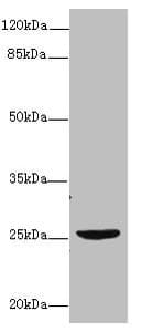 NEGR1 / Neurotractin Antibody