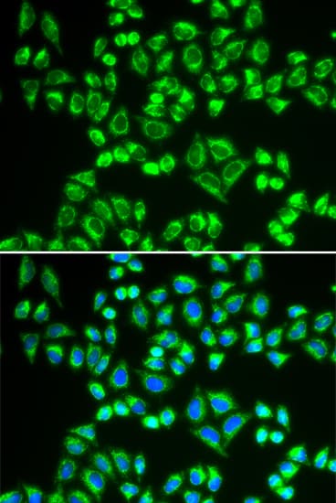 IHC-plus™ SHMT / SHMT2 Antibody