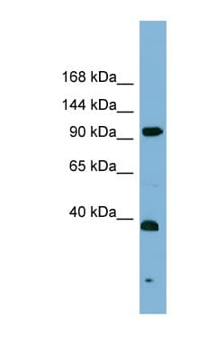 ERCC4 / XPF Antibody (aa431-480)