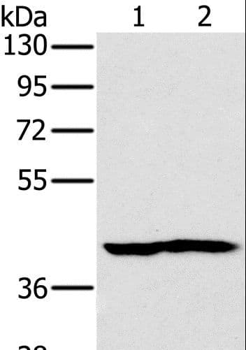 Polyclonal Rabbit anti-Human NDUFA10 Antibody (WB)
