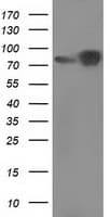 CTNNB1 / Beta Catenin Antibody (clone OTI9H2, Carrier-free)