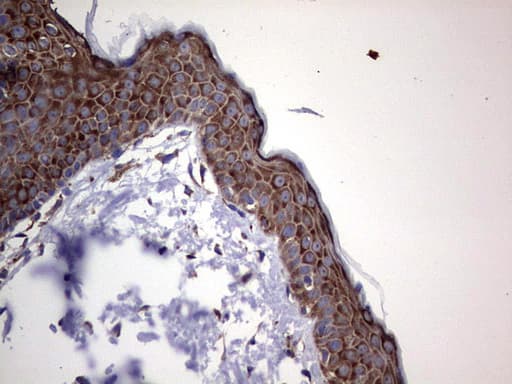 ANO1 / DOG1 / TMEM16A Antibody (aa1-333, clone OTI1C8)