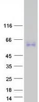 Human MXRA8 Protein (Recombinant Myc-DDK (Flag))