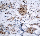 Polyclonal Rabbit anti-Human ER Alpha / Estrogen Receptor Antibody (IHC, IF, WB)