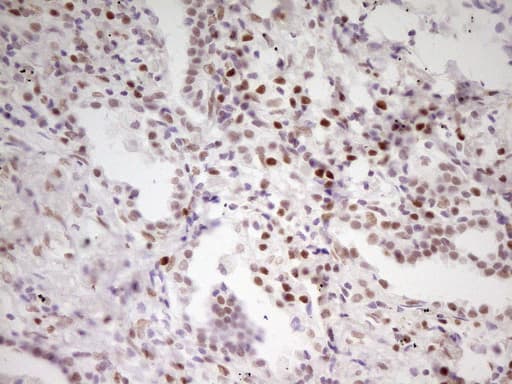 Monoclonal Mouse anti-Human MEF2D Antibody (clone OTI1E11, aa1-282, IHC, WB)