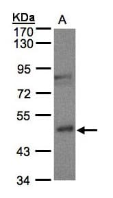 Polyclonal Rabbit anti-Human BBOX1 / BBOX Antibody (aa1-293, IHC, WB)