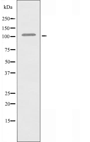 COL6A2 / Collagen VI Alpha 2 Antibody