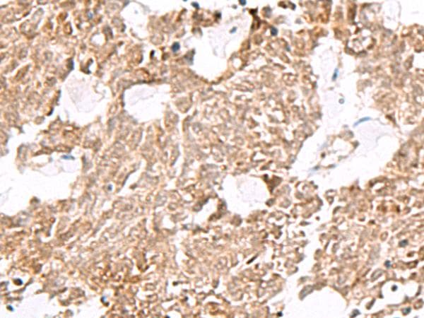 ELF3 / ESE1 Antibody