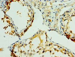 NLGN4Y Antibody (aa682-816)