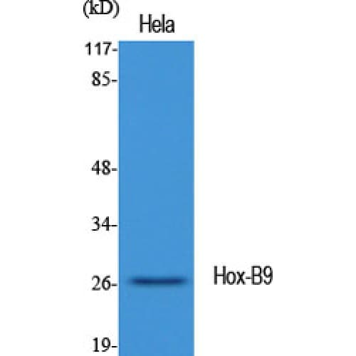 HOXB9 Antibody (180-260 aa, C-terminal)