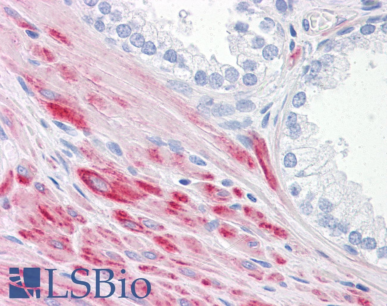 IHC-plus™ ADAMTS17 Antibody (clone 3B7)