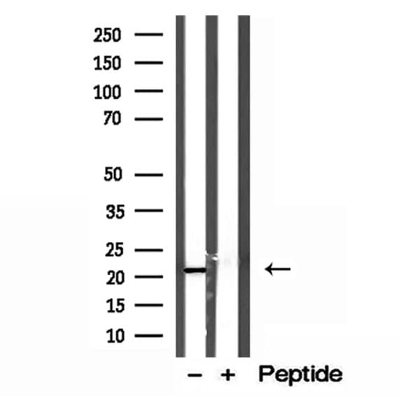 Polyclonal Rabbit anti-Human GPX7 Antibody (IHC, WB)