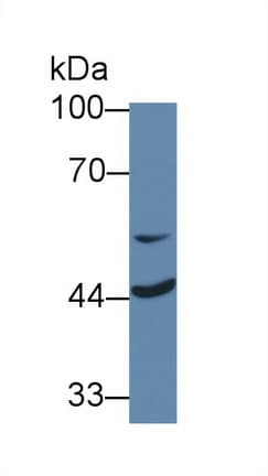 MTUS1 Antibody