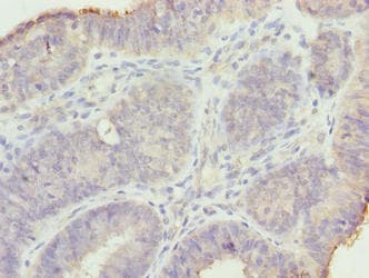 GAJ / MND1 Antibody
