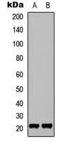 CDKN1A / WAF1 / p21 Antibody (phospho-Thr145)