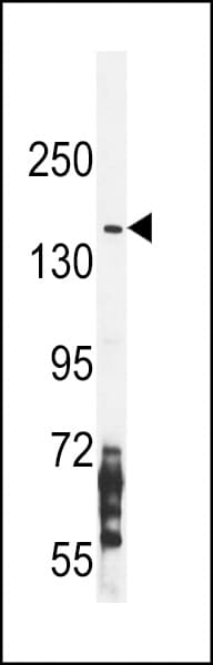 IHC-plus™ Polyclonal Rabbit anti-Human NOS2 / iNOS Antibody (aa830-860, IHC, IF, WB)