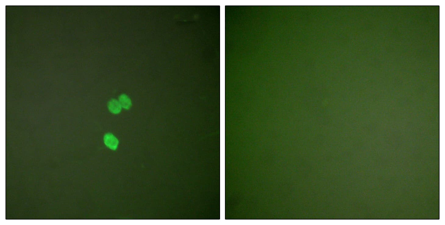 PathPlus™ LGALS3 / Galectin 3 Antibody (aa141-190)