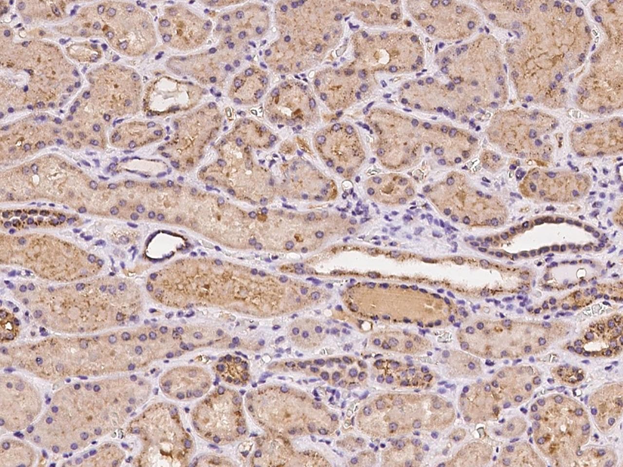 Polyclonal Rabbit anti-Human RBCK1 Antibody (IHC)
