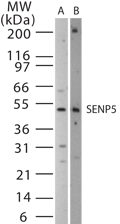 SENP5 Antibody (aa229-246)