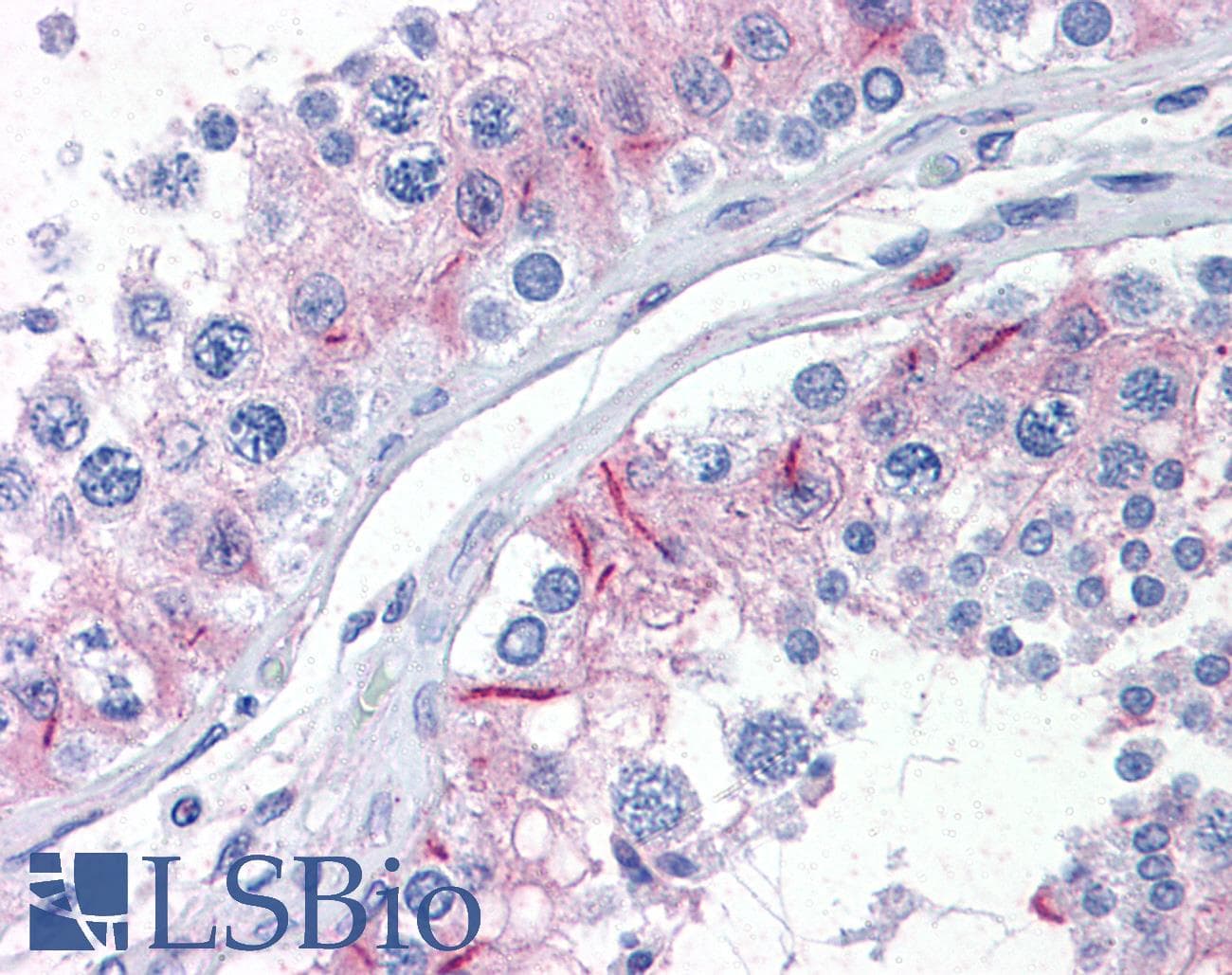 IHC-plus™ Zyxin Antibody (clone 2D1)