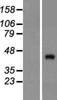 ZNF474 Protein (Over-Expression Lysate Myc-DDK (Flag))