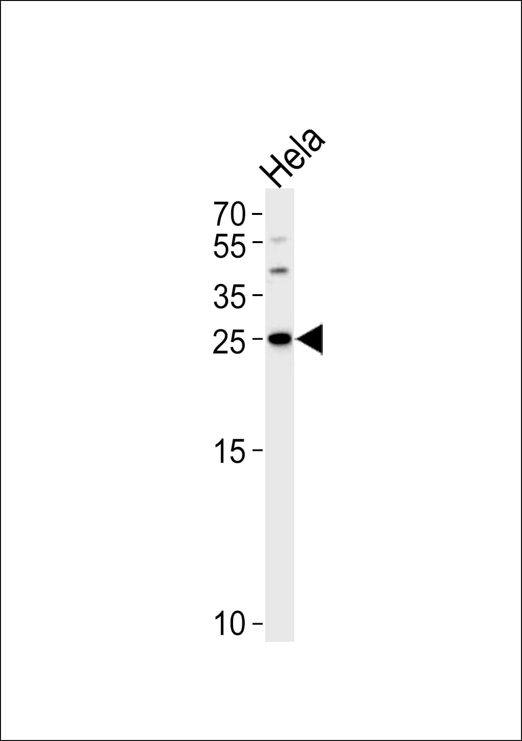YWHAG / 14-3-3 Gamma Antibody (aa136-164)
