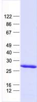 Human CBX2 Protein (Recombinant His, N-Terminal)