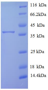 Human TMEM14B Protein (Recombinant GST)