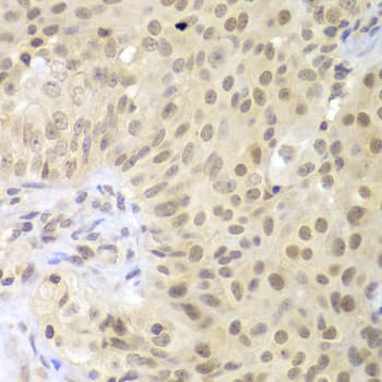 LHX4 Antibody