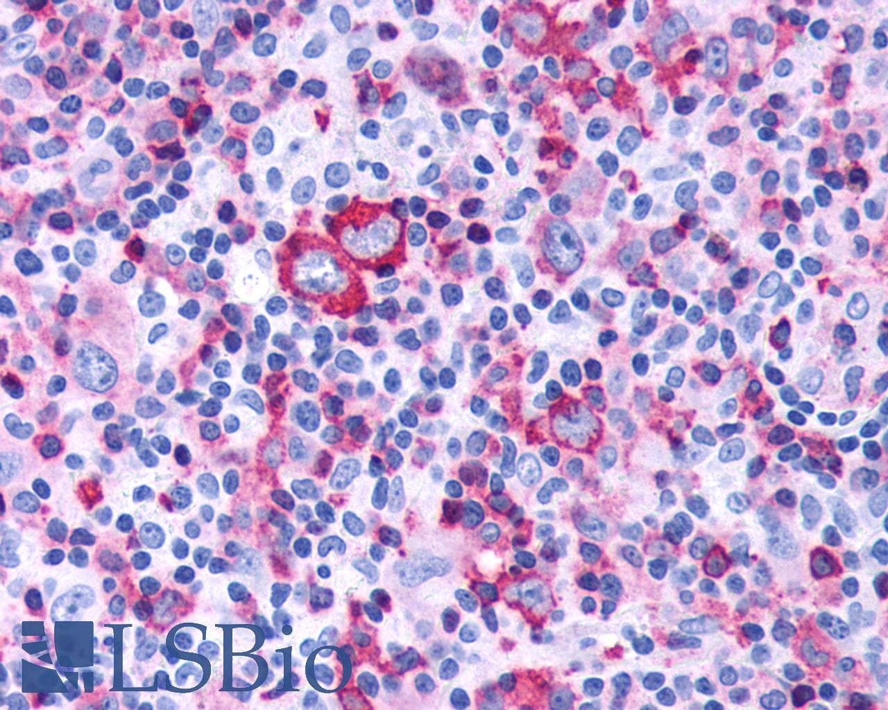 IHC-plus™ FZD4 / Frizzled 4 Antibody (N-Terminus)