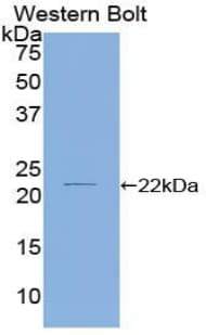 CFL2 / Cofilin 2 Antibody (aa1-156, APC)