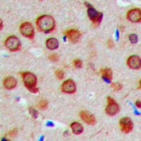 MRPS5 Antibody (C-Terminus)