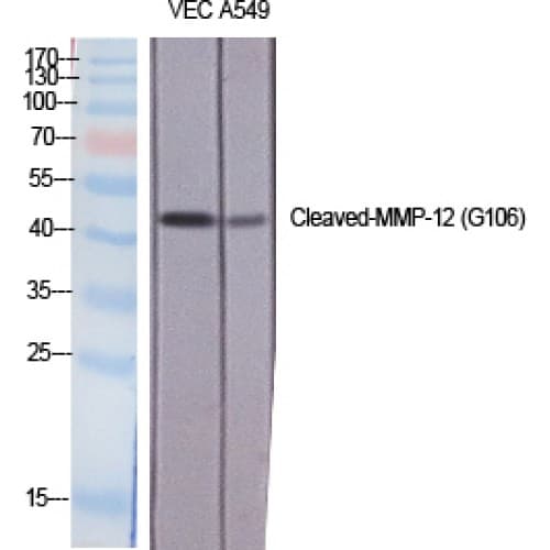 MMP12 Antibody (60-140 aa, Internal)