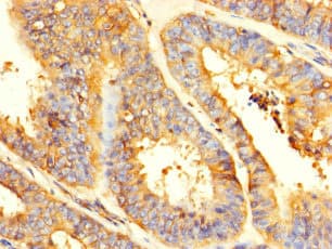 Polyclonal Rabbit anti-Human GPD2 Antibody