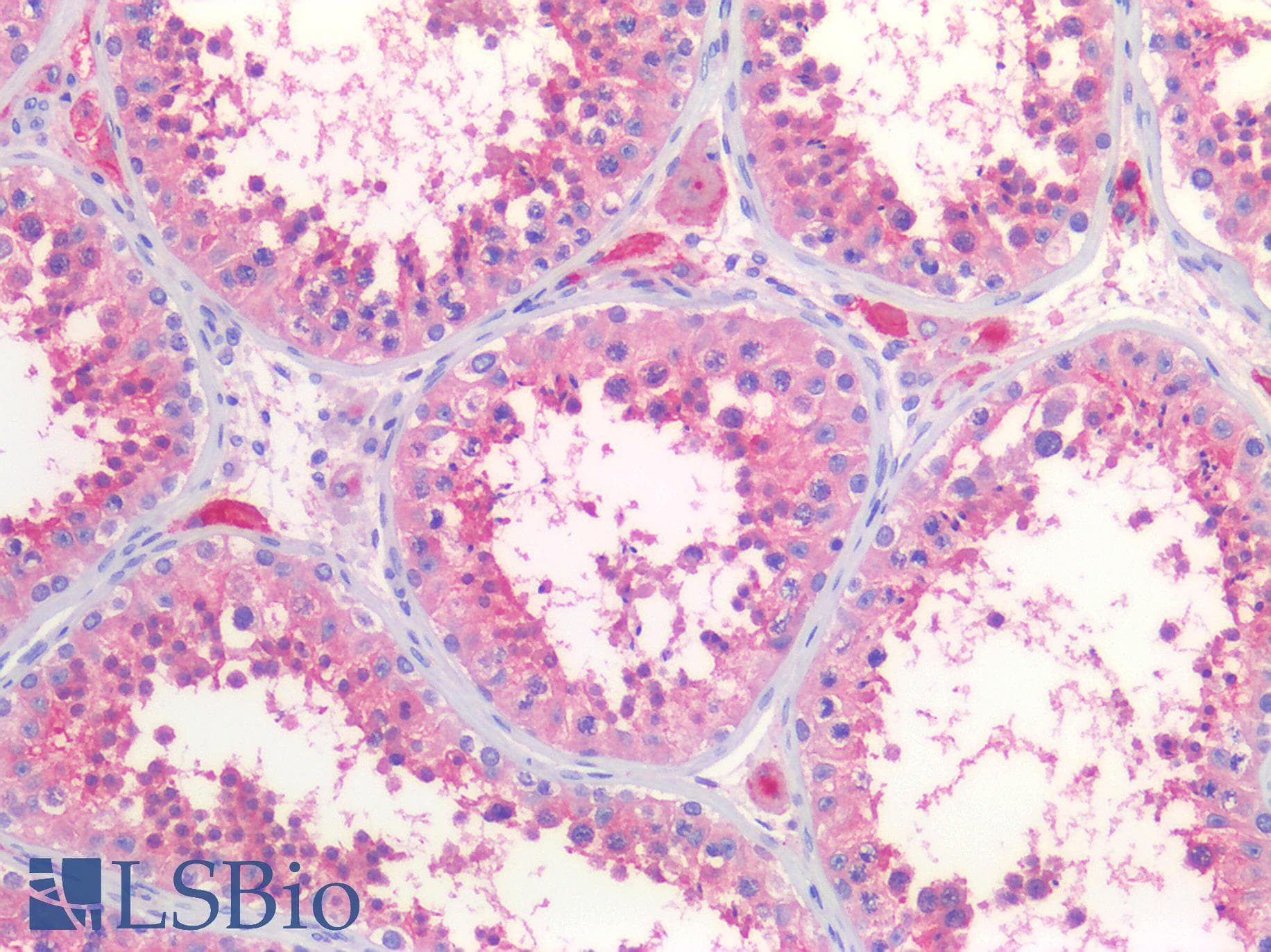 IHC-plus™ ACE2 / ACE-2 Antibody (aa773-805)