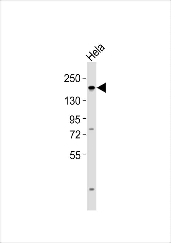 TOP2A / Topoisomerase II Alpha Antibody