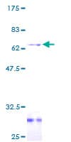 Human ARH / LDLRAP1 Protein (Recombinant GST)