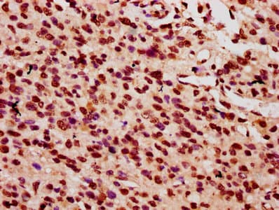HIST1H2AI Antibody