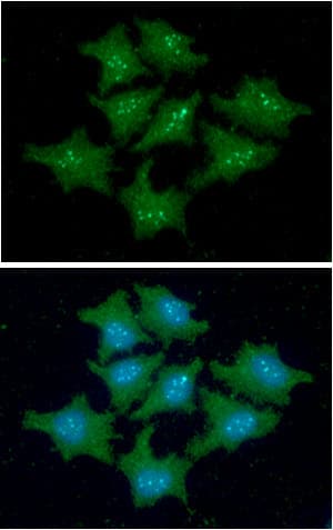 FKBP14 Antibody (clone AT18E2)