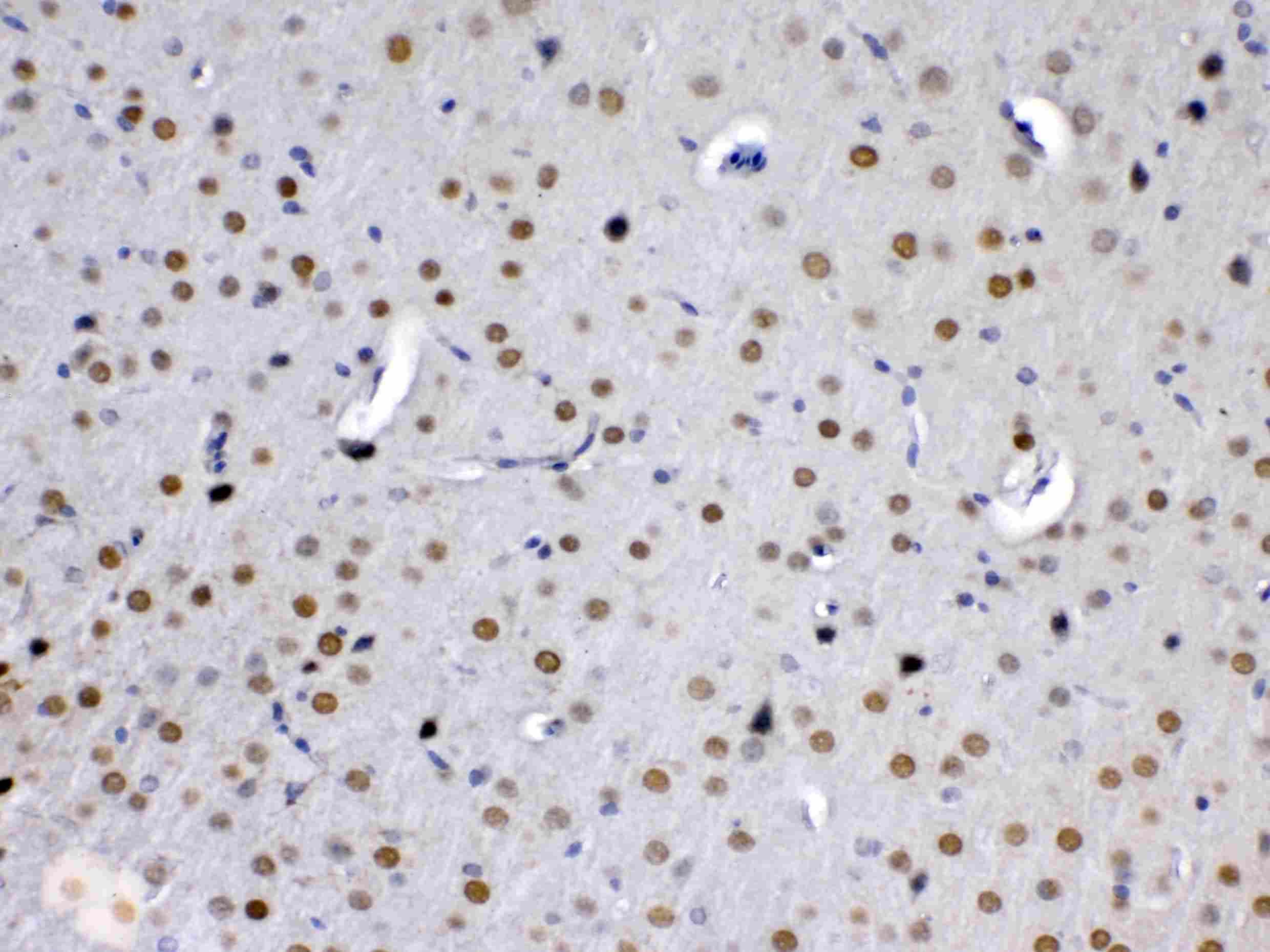 MED15 / ARC105 Antibody