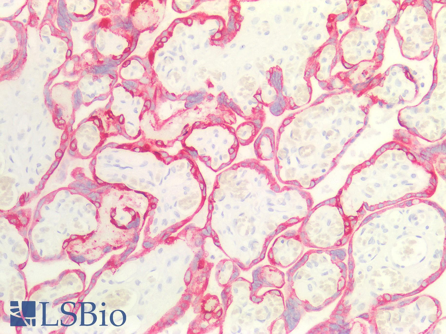PathPlus™ Monoclonal Mouse anti-Human Acidic Cytokeratin AE1 Antibody (clone AE1, IHC)