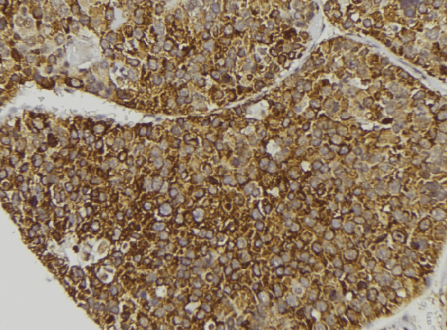 Polyclonal Rabbit anti-Human APOL3 / Apolipoprotein L 3 Antibody (IHC, WB)